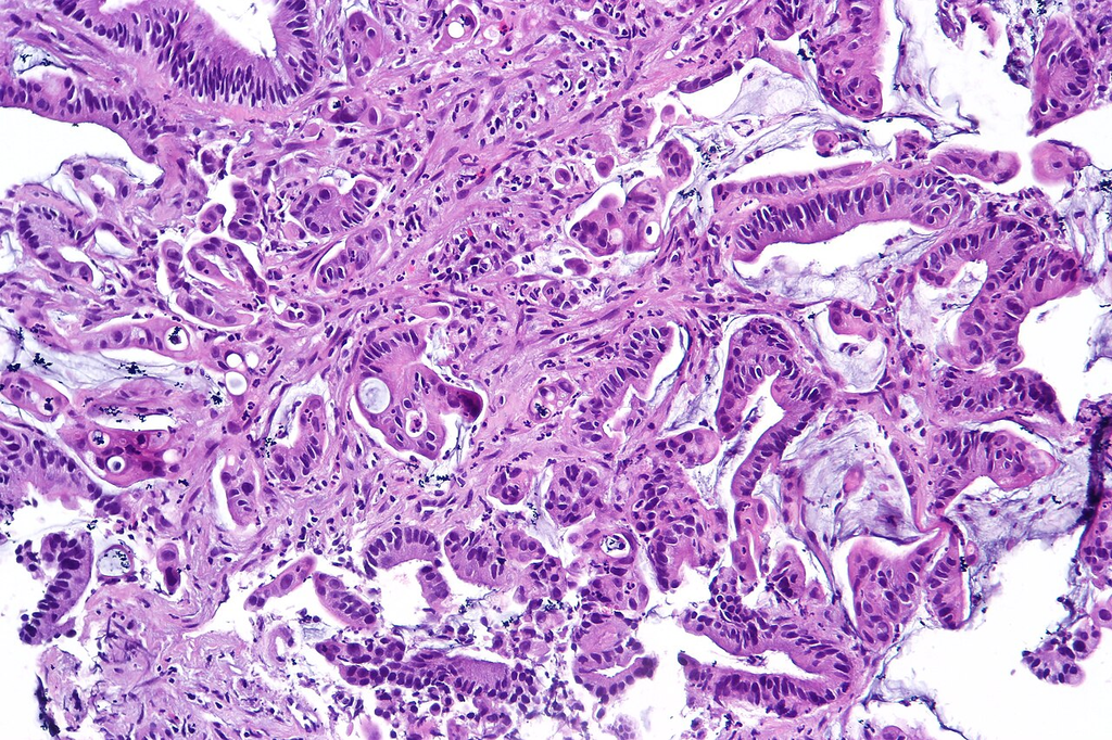 tissue_he__he__99c7ec2f319d