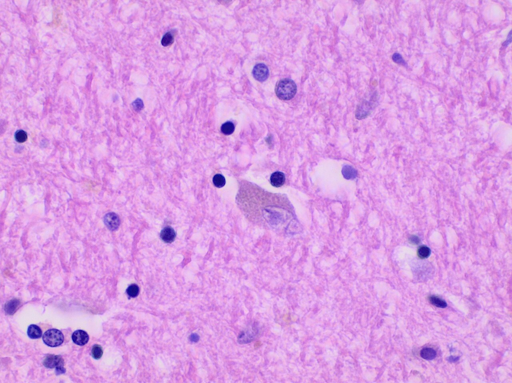 tissue_he__he__c7b274a608e4