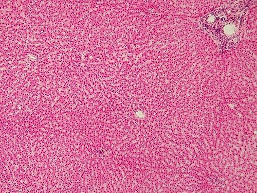 Normal Human Liver — H&E