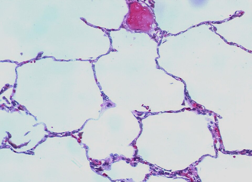 Normal Lung — Alveoli