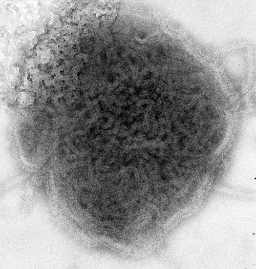 Mumps Virus — Negative Stain TEM