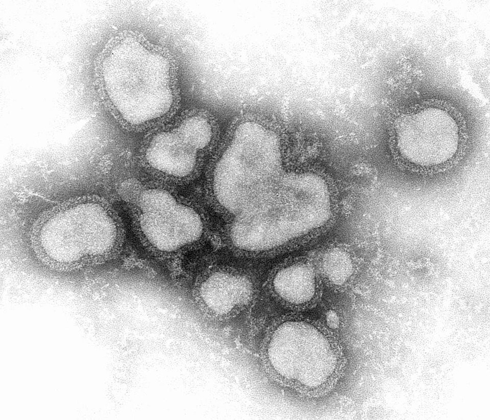 Influenza A Virus — Negative Stain TEM
