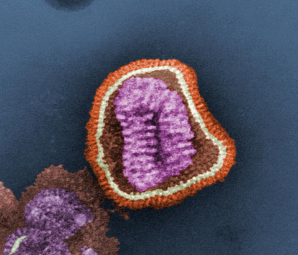 Influenza Virus — Negative Stain TEM